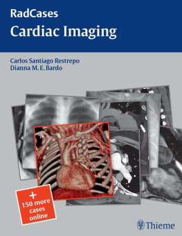 Carlos Restrepo Cardiac Imaging (Radcases Plus Q&A)