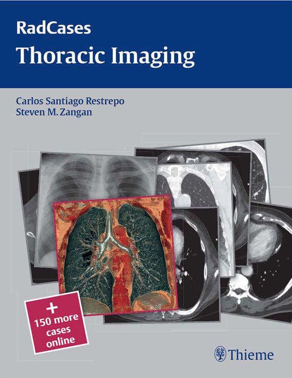 Thoracic Imaging Edited by Carlos Santiago Restrepo MD Professor of - photo 1