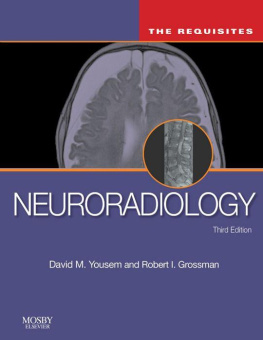 David M. Yousem - Neuroradiology: The Requisites