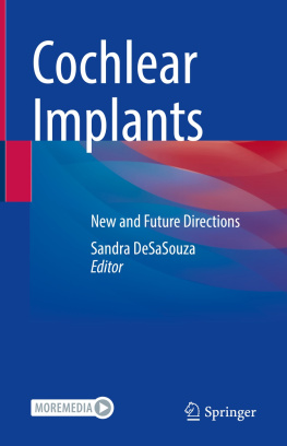 Sandra DeSaSouza Cochlear Implants: New and Future Directions