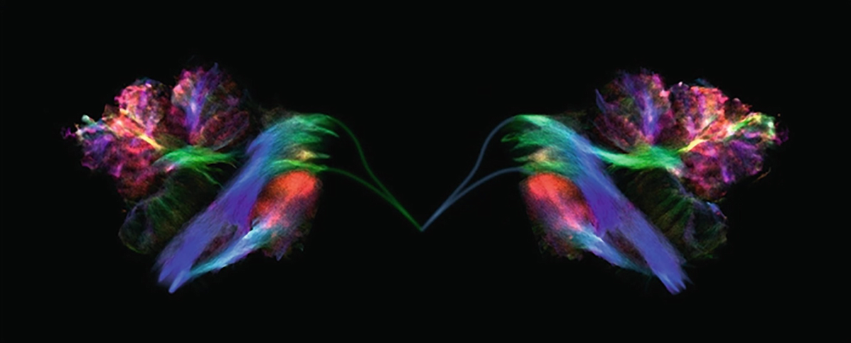 Hummingbirds Colour-coded tract-density images generated from 08 mm - photo 3