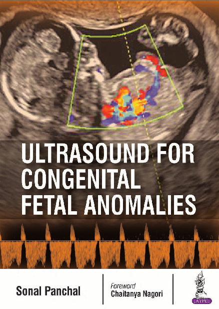 ULTRASOUND for Congenital Fetal Anomalies ULTRASOUND for - photo 1