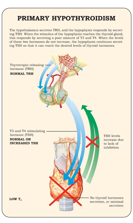 The increase in the levels of T3 and T4 results in a negative feedback both in - photo 19