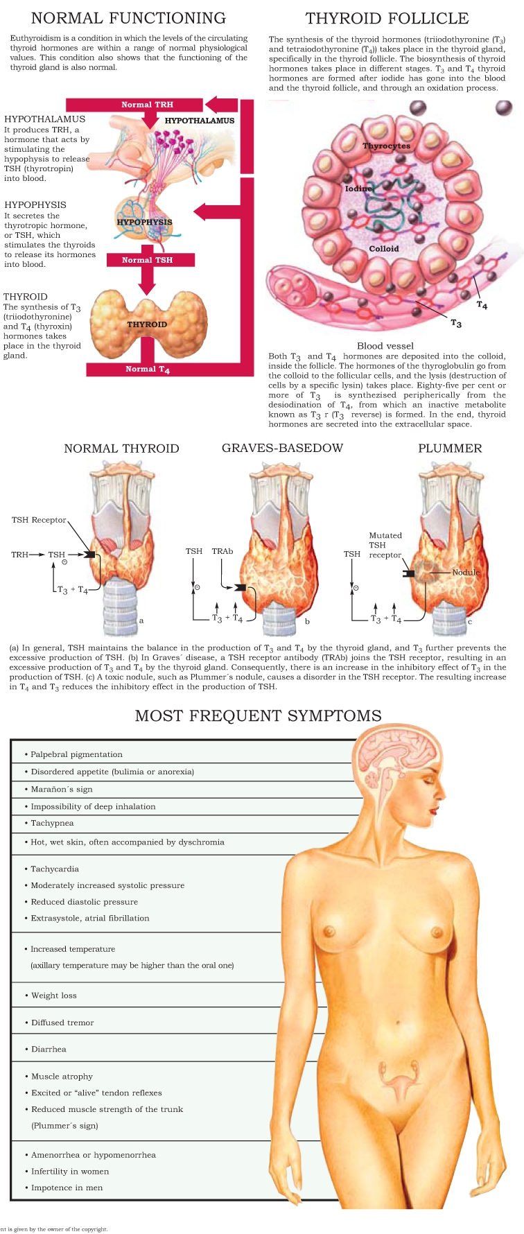 This disorder which encompasses a whole set of anatomopathological structures - photo 6