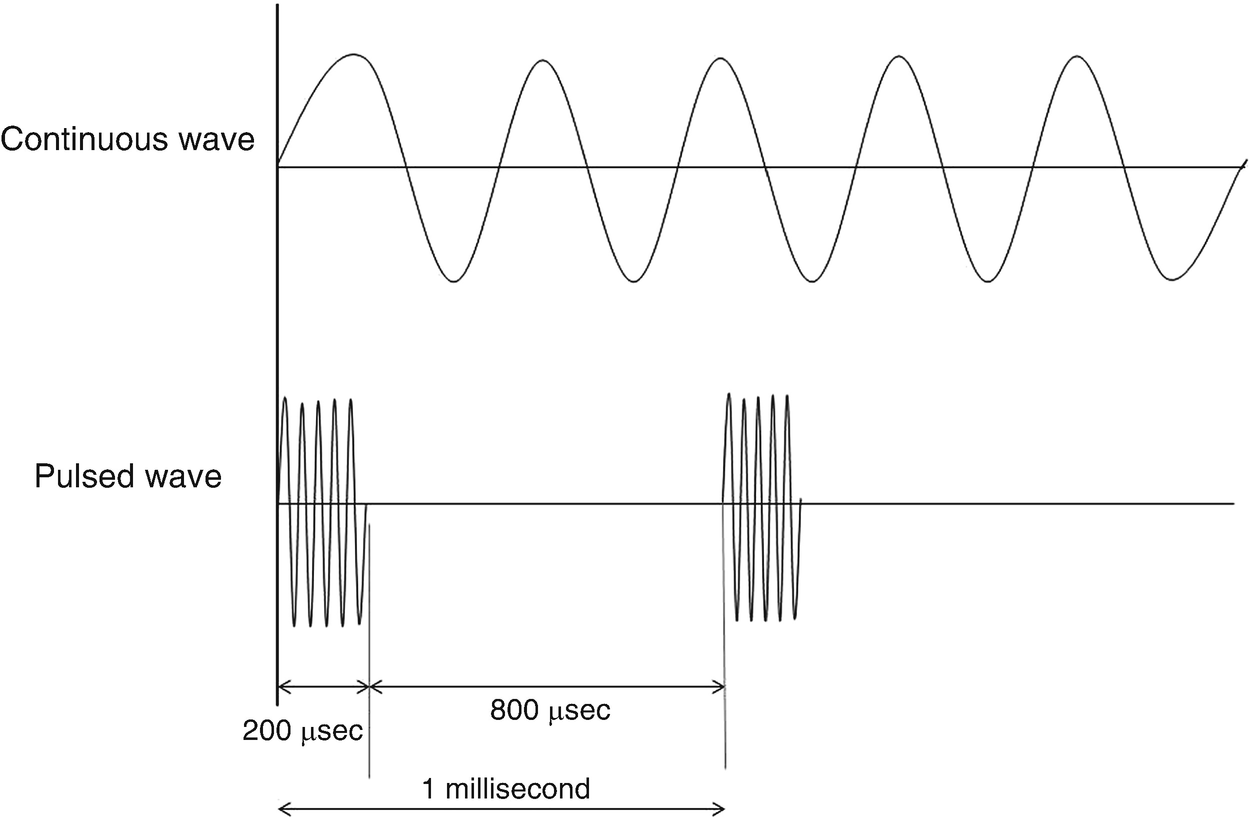 Fig 11 Ultrasound waveform continuous and pulsed Low-intensity pulsed - photo 3