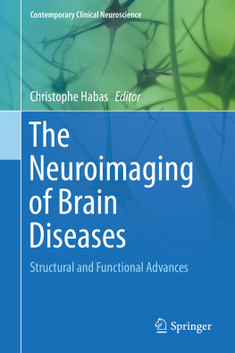 Christophe Habas (editor) The Neuroimaging of Brain Diseases: Structural and Functional Advances