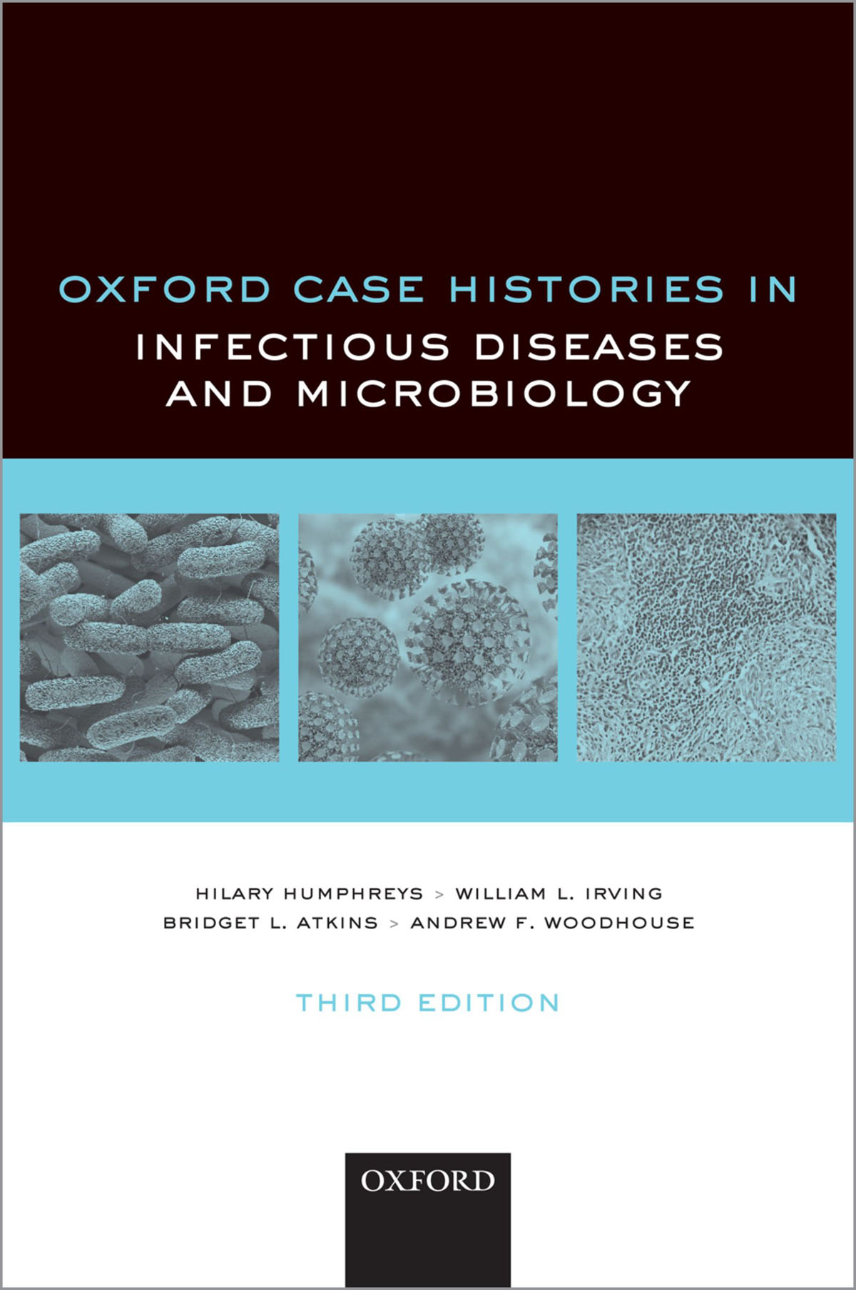 Oxford Case Histories in Infectious Diseases and Microbiology Oxford Case - photo 1