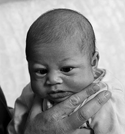 The windy stare is present from birth and can be described as a far off gaze to - photo 1