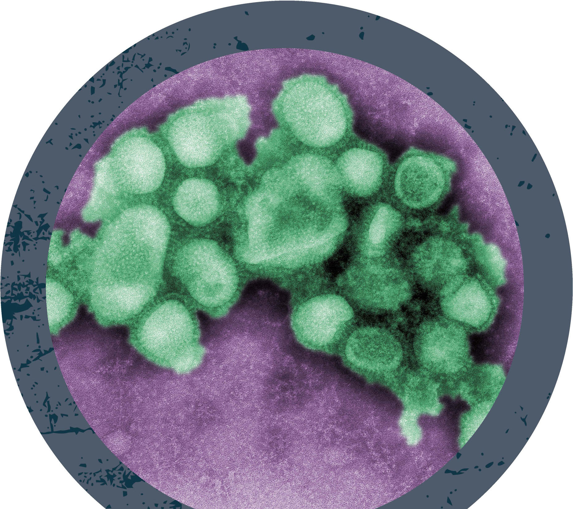 swine flu under a microscope Influenza A has subtypes based on combinations of - photo 5