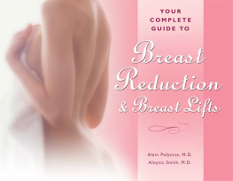 Alain Polynice Your Complete Guide to Breast Reduction and Breast Lifts