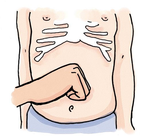 4Pull your fist upward into your childs abdomen with up to 5 quick distinct - photo 6