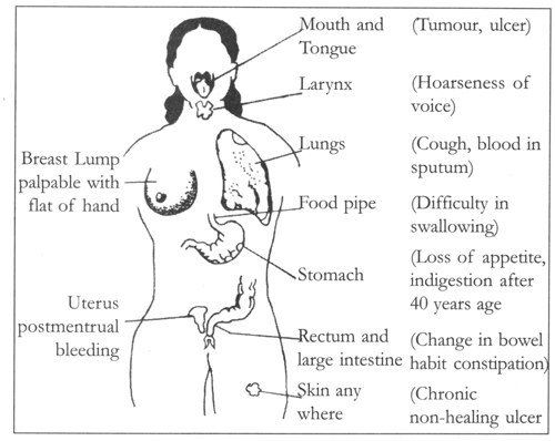 1 Pain Pain is usually considered to be one the chief symptoms of cancer but - photo 1