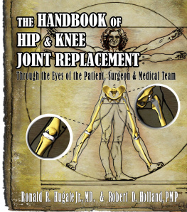 Robert Holland - Handbook of Hip & Knee Joint Replacement: Through the Eyes of the Patient, Surgeon & Medical Team