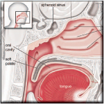 Ear Nose and Throat - photo 5