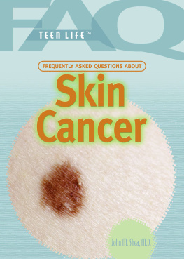 John M. Shea - Frequently Asked Questions about Skin Cancer