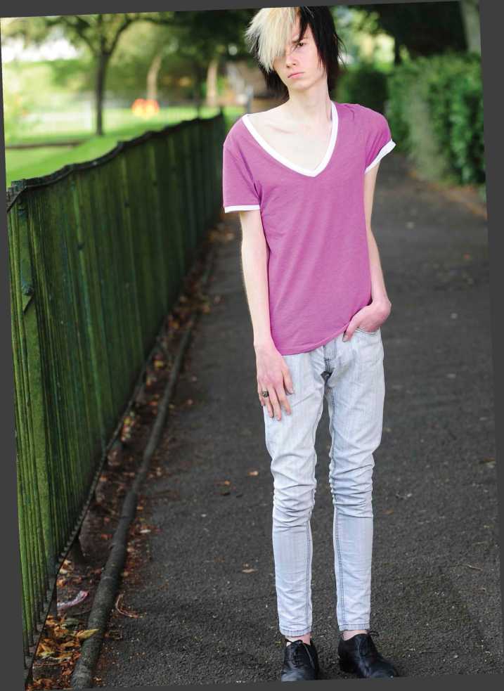 This young man is in recovery from anorexia The diseases full name is - photo 5