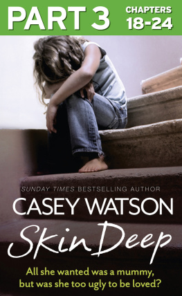 Casey Watson - Skin Deep, Part 3 of 3: All she wanted was a mummy, but was she too ugly to love?