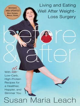 Susan Maria Leach Before & After, Revised Edition: Living & Eating Well After Weight Loss Surgery