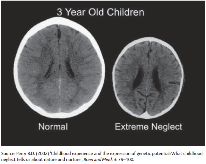 This brain scans picture has become iconic a key motif in political and - photo 3