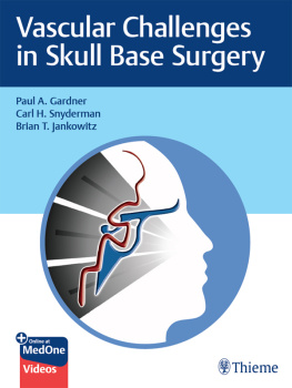 Paul Gardner Vascular Challenges in Skull Base Surgery