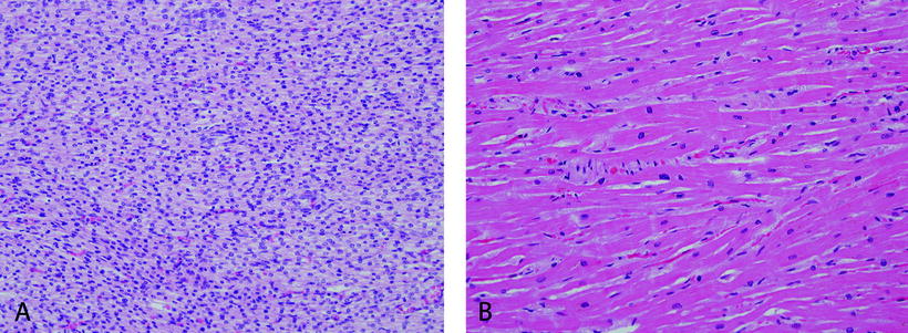 Figure 1-1 Comparison of fetal and adult myocardium A Fetal myocardium at - photo 1