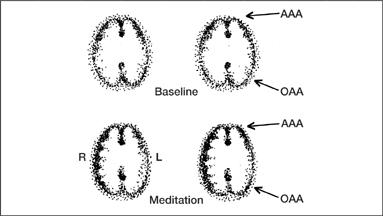 Figure 11 The top row of images shows the meditators brain at rest and - photo 3