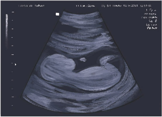 Ultrasound image of a fetus before birth Midwives nurses and other healthcare - photo 15