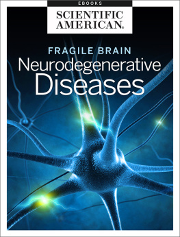 Scientific American Editors Fragile Brain: Neurodegenerative Diseases