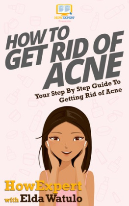 HowExpert - How To Get Rid of Acne: Your Step By Step Guide To Getting Rid of Acne