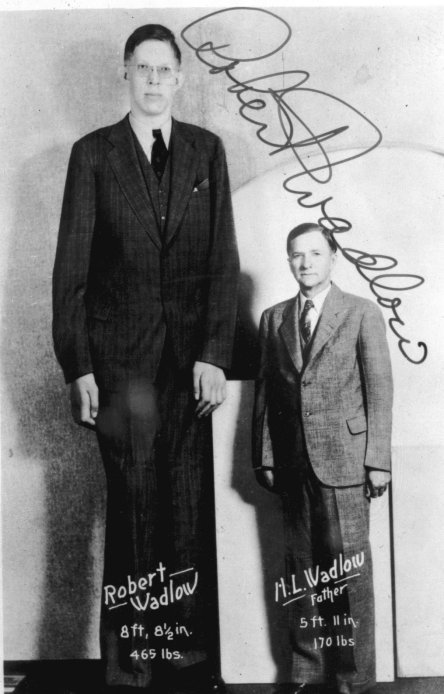 Robert Wadlow The Unique Life of the Boy Who Became the Worlds Tallest Man - photo 6