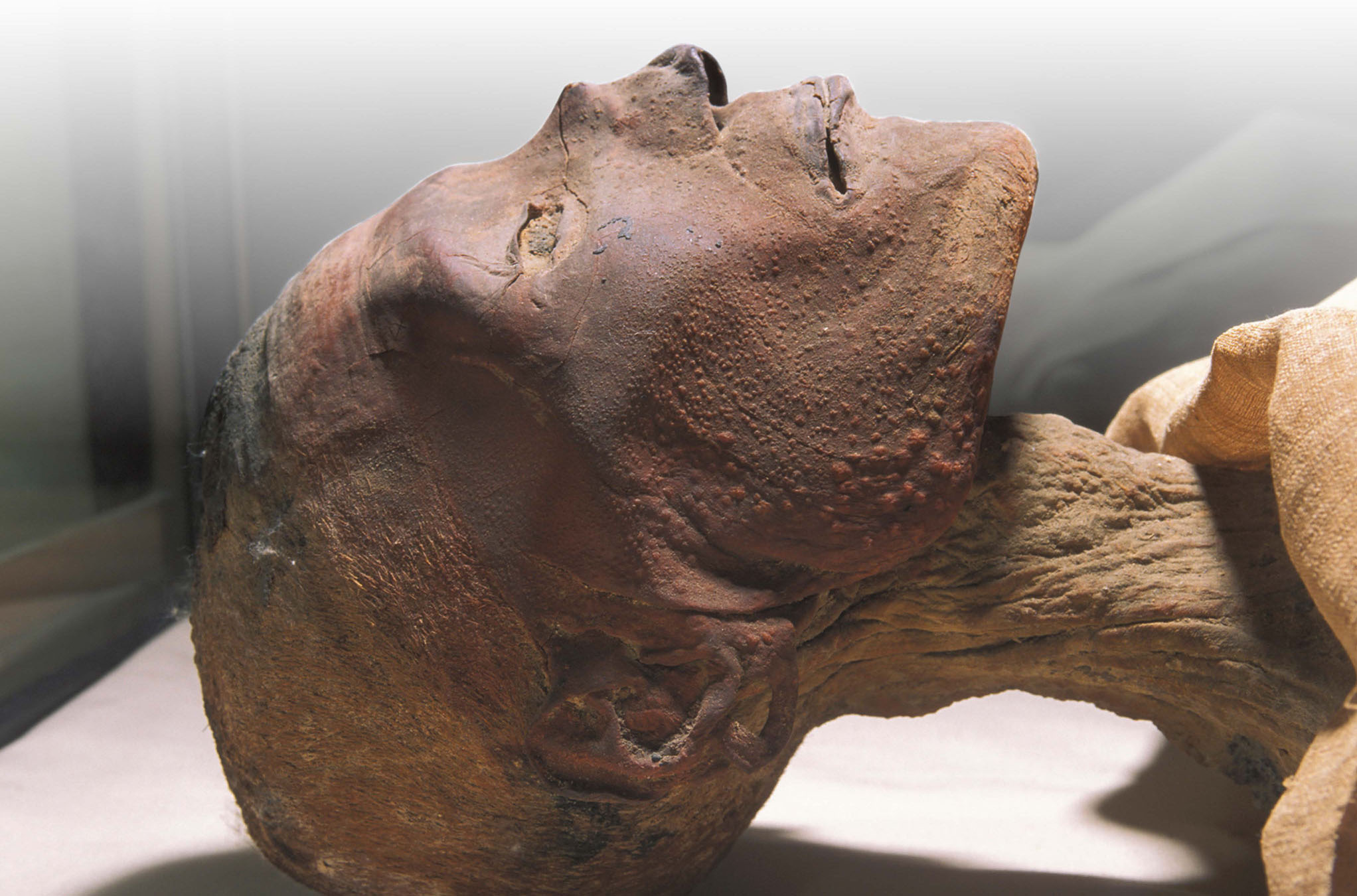 Pharaoh Ramses V may have died from smallpox European settlers brought the - photo 7