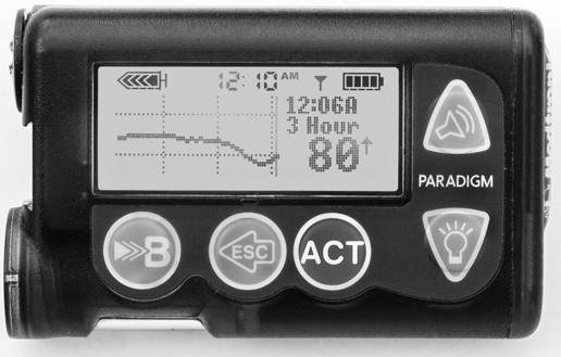 Figure 14Receivers and displays CGM receivers display a variety of important - photo 8