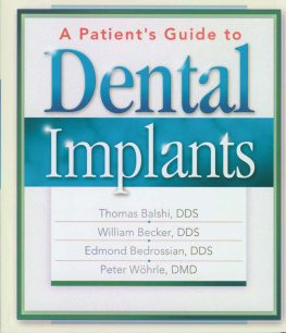William Becker - A Patients Guide to Dental Implants