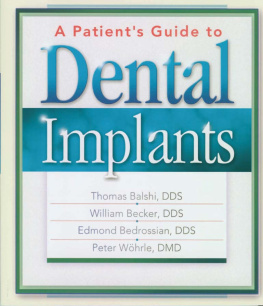 William Becker A Patients Guide to Dental Implants