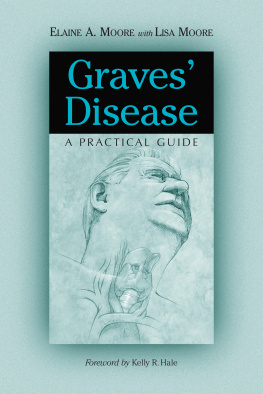 Elaine A. Moore Graves Disease: A Practical Guide