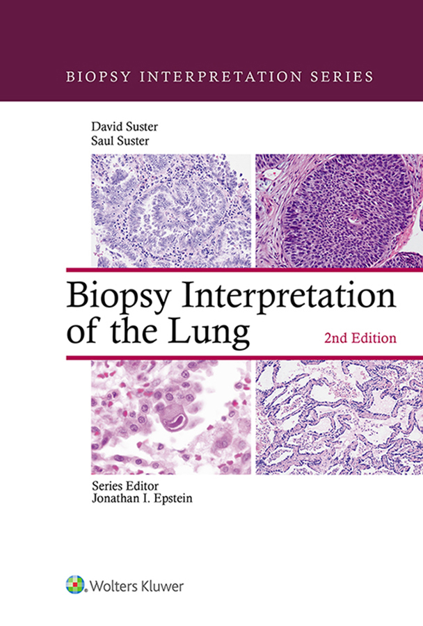 Biopsy Interpretation Series Biopsy Interpretation of the Lung Second Edition - photo 1