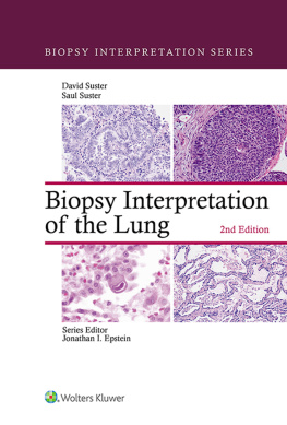 Saul Suster - Biopsy Interpretation of the Lung