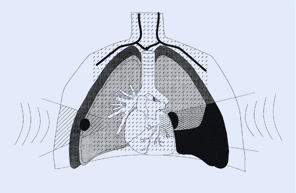 Fig 12 Entities and pathological changes that can be accessed by ultrasound - photo 4