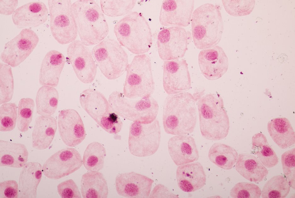 Prokaryotic Cells- These cells contain no nucleus They are the small and - photo 24