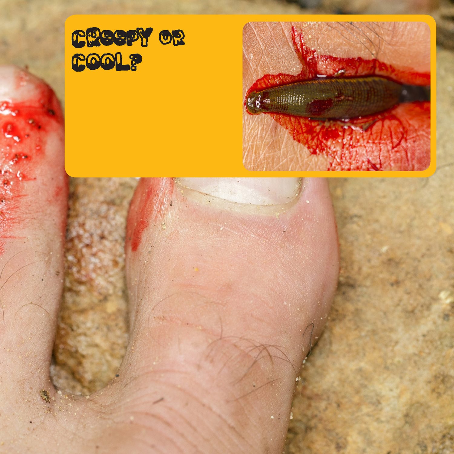 Creepy OR Cool Leeches have a chemical in their saliva that stops - photo 7