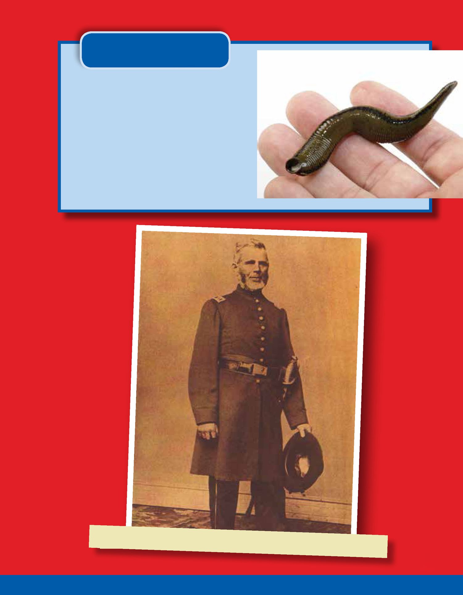 Fun Fact Clara put leeches on her brother This was a common cure at the time - photo 8