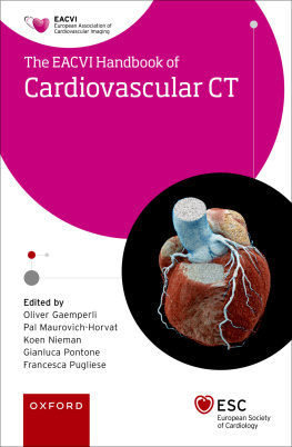 Oliver Gaemperli - EACVI Handbook of Cardiovascular CT