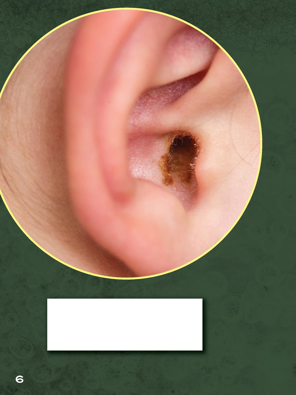 Earwax traps dust and germs so they dont hurt your ears - photo 8