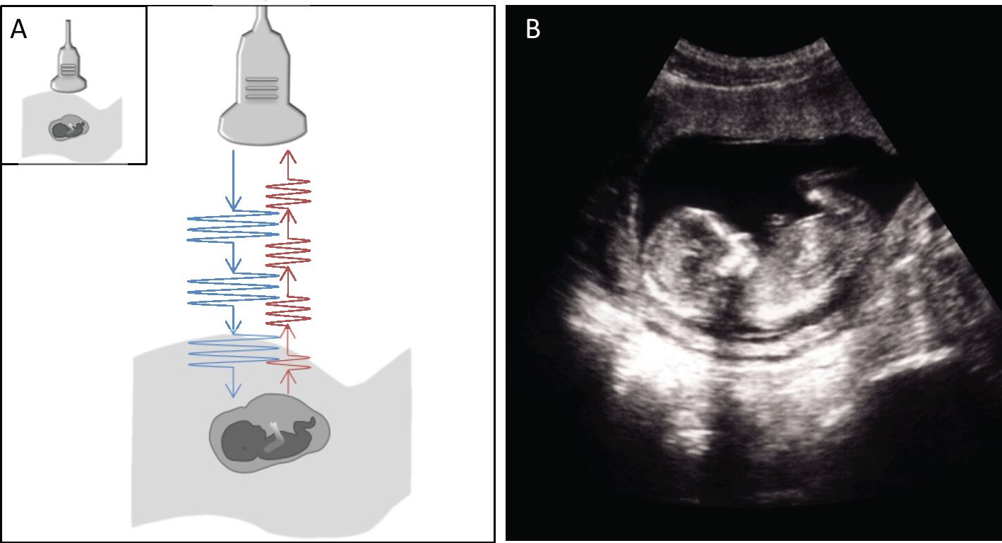 Figure 12 Ultrasound probes send and receive ultrasound A Schematic - photo 4