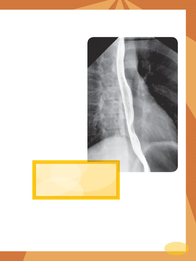 Your Esophagus and Your Trachea Your throat sits at the top of two tubes - photo 13