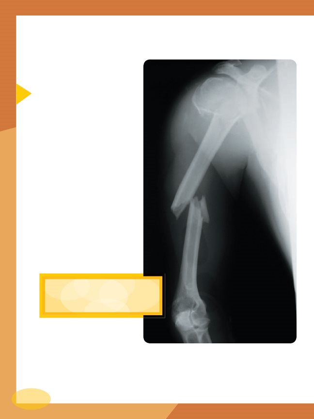 In and around Bones Most of a bones surface is covered with a thin layer - photo 10