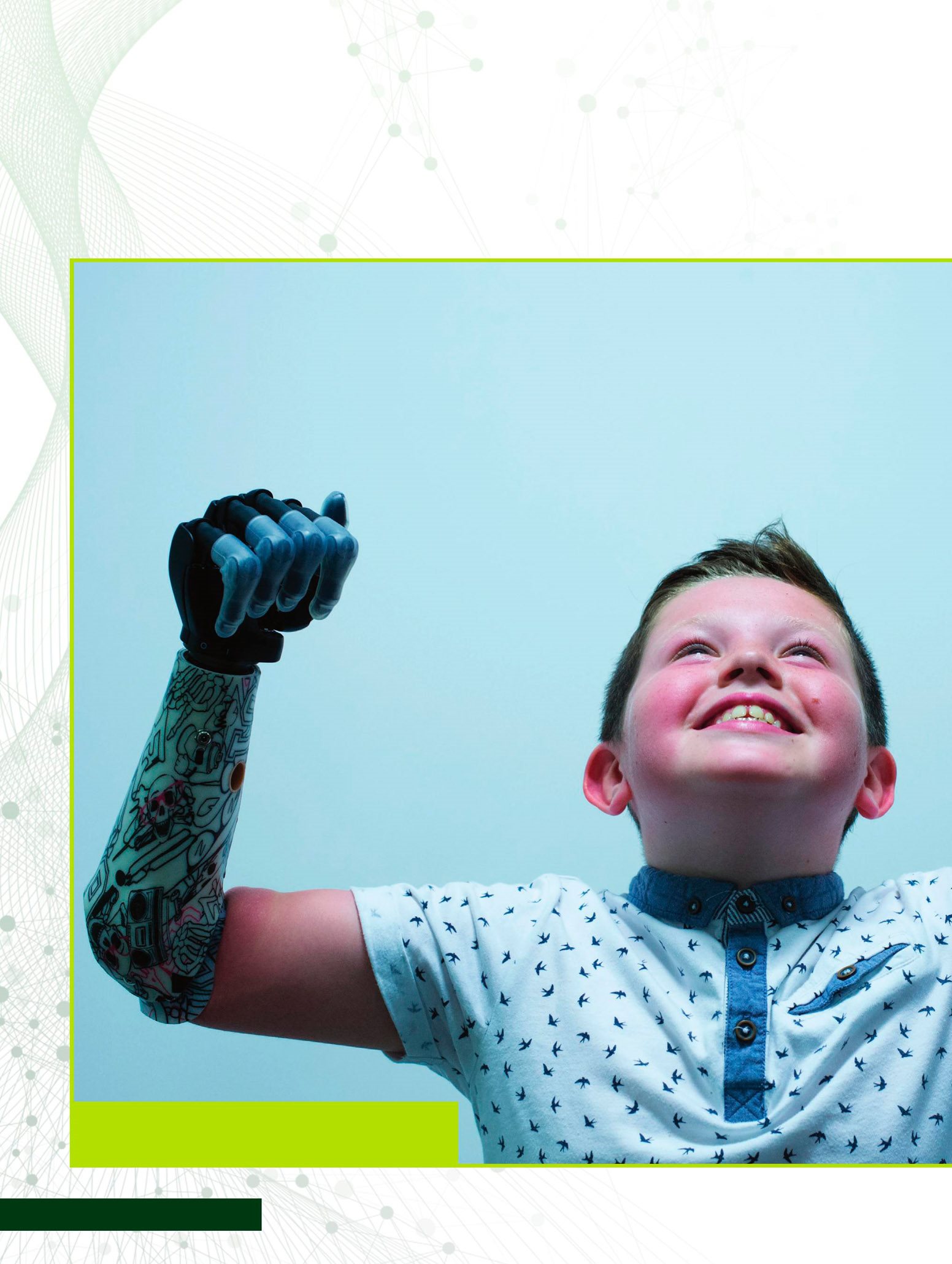 In 2015 nine-year-old Josh Cathcart was fitted with a bionic hand in - photo 9