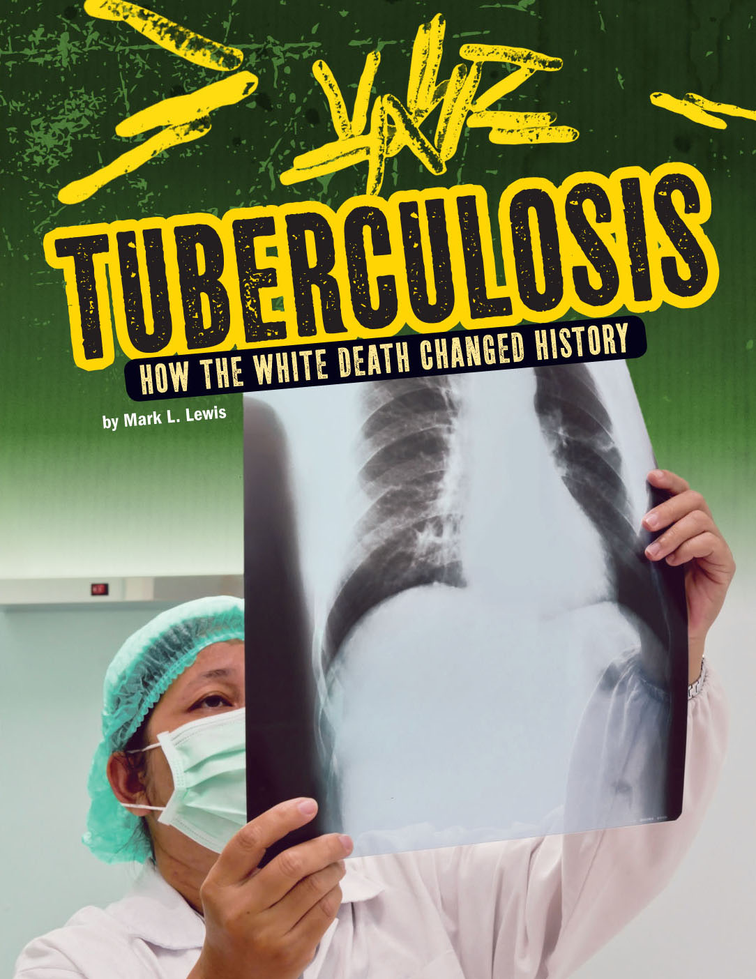 CHAPTER 1 A DRUG-RESISTANT DISEASE Patients filled the waiting room of a - photo 1