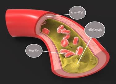 The main source of the body fuel is glucosewhich can be obtained from three - photo 3