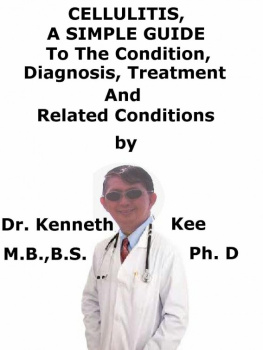 Kenneth Kee Cellulitis, A Simple Guide To The Condition, Diagnosis, Treatment And Related Conditions